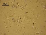 5 - Cellule stellate midollari con lunghe braccia